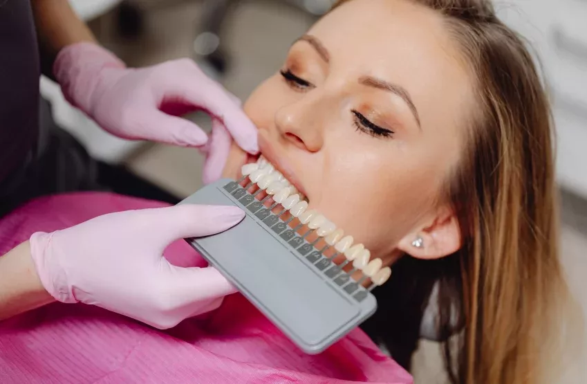 Tratamiento de blanqueamiento dental de Clínica Dental Isabel Cuesta en Siero