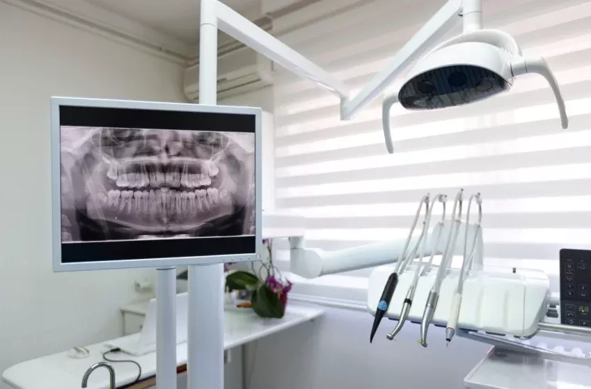 Servicio de radiología oral digital de Clínica Dental Isabel Cuesta en Siero