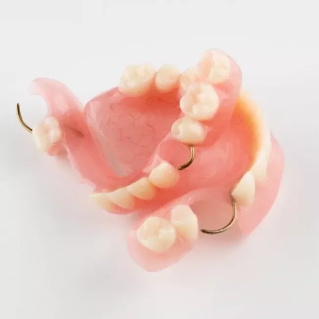 Tratamiento de prótesis dentales de Clínica Dental Isabel Cuesta en Siero