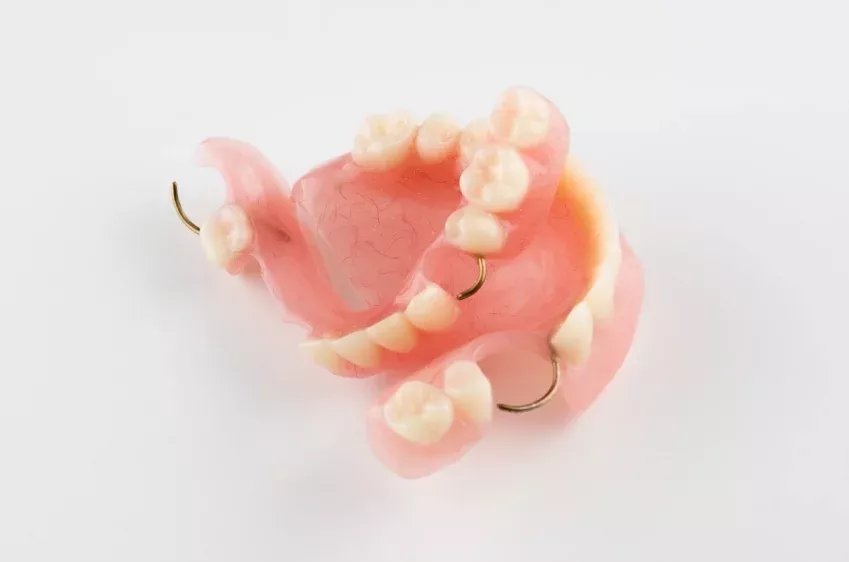 Tratamiento de prótesis dentales de Clínica Dental Isabel Cuesta en Siero