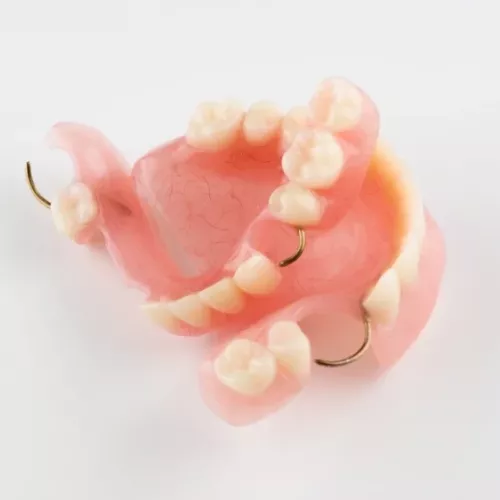 Tratamiento de prótesis dentales de Clínica Dental Isabel Cuesta en Siero