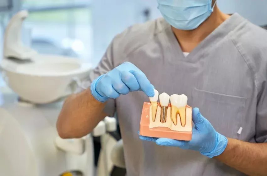 Tratamiento de implantes dentales de Clínica Dental Isabel Cuesta en Siero