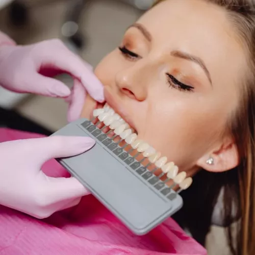 Tratamiento de blanqueamiento dental de Clínica Dental Isabel Cuesta en Siero