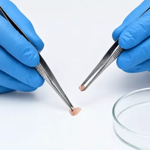 Servicio de biopsias orales de Clínica Dental Isabel Cuesta en Siero
